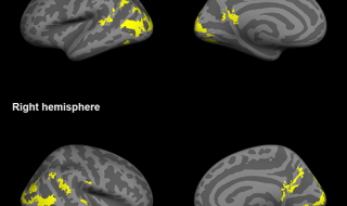 In deze afbeelding worden hersengebieden (in geel) getoond waaruit activiteitenpatronen worden verzameld om inzicht te krijgen in wat personen van een merklogo vinden.