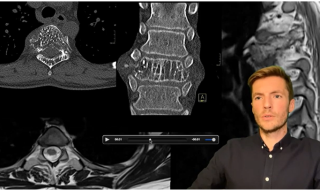 Screenshot Poli Radiologie met radiologische beelden en een persoon
