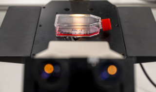 Flesje met rode vloeistof onder microscoop