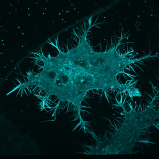 N1e-115 neuroblastoom-cel