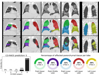 CT-scans van longen met positieve CO-RADS-uitslag