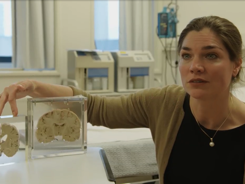 Henne Holstege met plakjes hersenen tussen glasplaten in een ziekenhuissetting